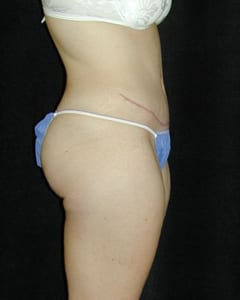 Patient Before And After Photos